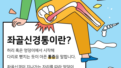 급증하는 좌골신경통